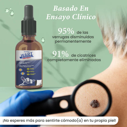 REMOVEDOR DE VERRUGAS Y LUNARES - ACCION RAPIDA Y EFECTIVA