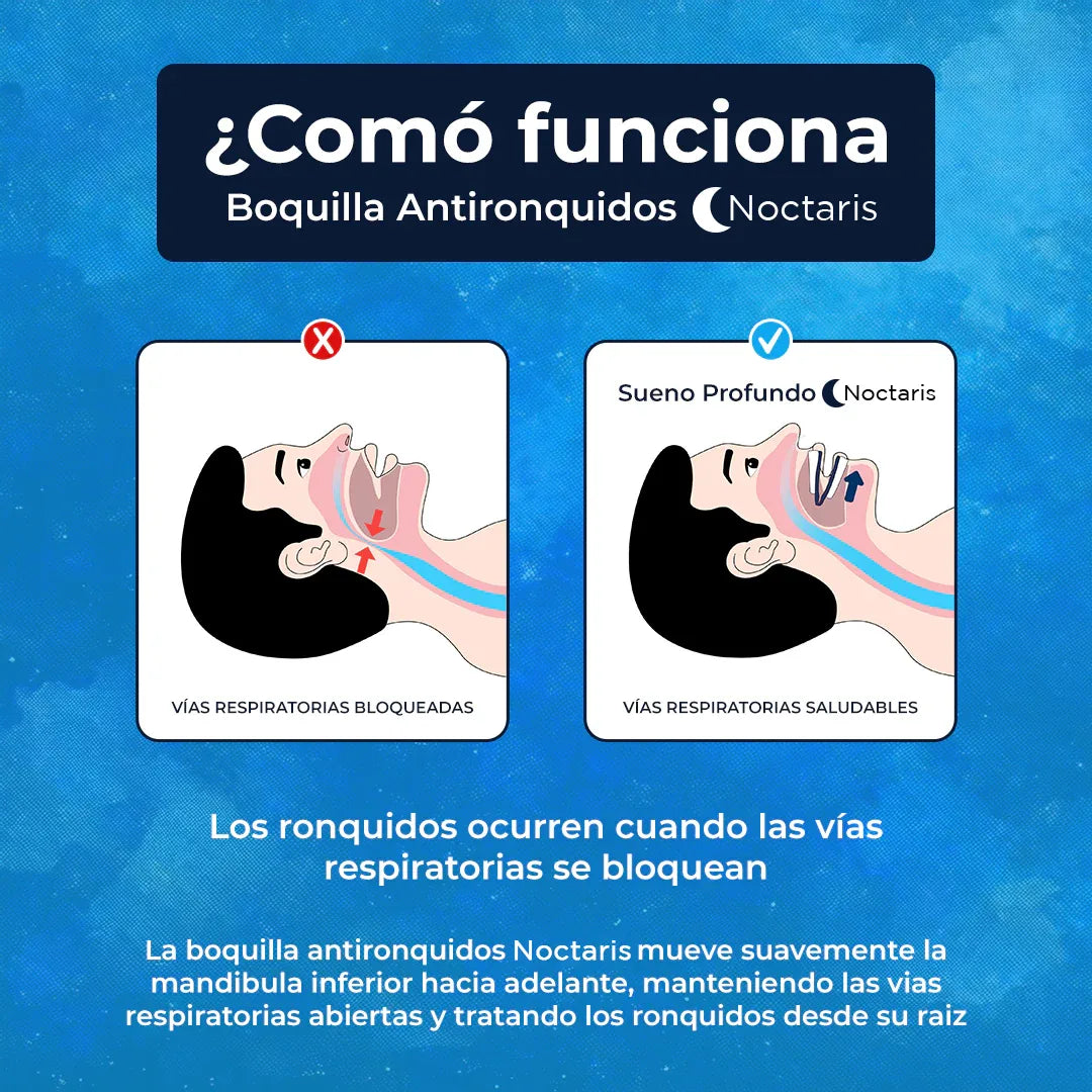 AirSilent™ – Boquilla ajustable que elimina ronquidos y mejora tu descanso nocturno