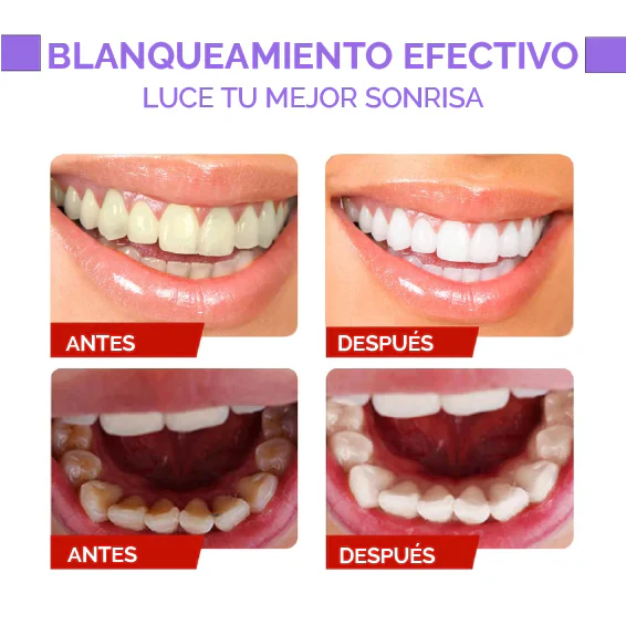 Colour Corrector™ - Luce una sonrisa resplandeciente y reduce el mal aliento