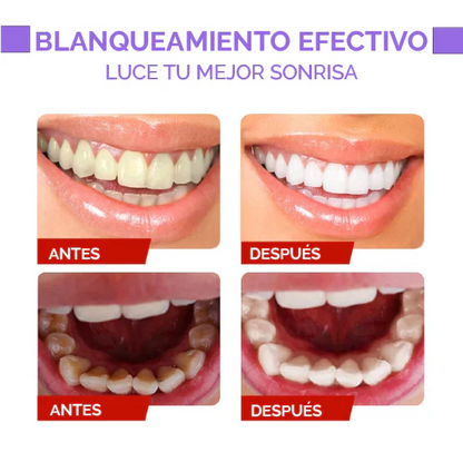 Colour Corrector™ - Luce una sonrisa resplandeciente y reduce el mal aliento