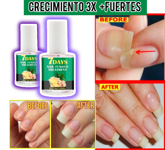 HydraNail™ PACK X3 - Acelera el crecimiento de las uñas y elimina hongos
